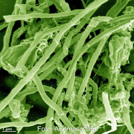 längliche grüne Formen - die Urzeitmikroben Archaeen.